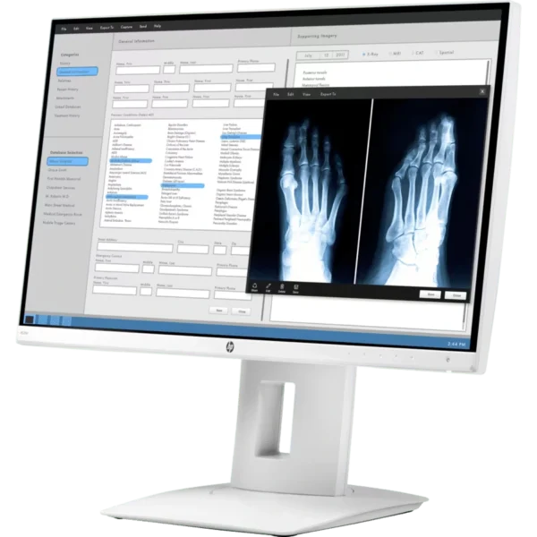 مانیتور استوک مدل اچ پی HP HC240 24-INCH